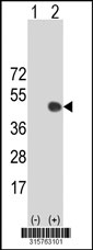 Western blot analysis of his-tag FTSJ1 (arrow) using his tag antibody. 293T cell lysates (2 ug/lane) either nontransfected (Lane 1) or transiently transfected with the FTSJ1 gene‘