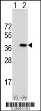 Western blot analysis of his-tag LDHC (arrow) using his tag antibody. 293 cell lysates (2 ug/lane) either nontransfected (Lane 1) or transiently transfected with the LDHC gene
