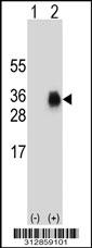 Western blot analysis of his-tag TM4SF1 (arrow) using his tag antibody. 293 cell lysates (2 ug/lane) either nontransfected (Lane 1) or transiently transfected with the TM4SF1 gene