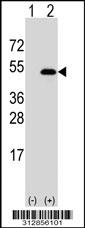 Western blot analysis of his-tag RPSA (arrow) using his tag antibody. 293 cell lysates (2 ug/lane) either nontransfected (Lane 1) or transiently transfected with the RPSA gene