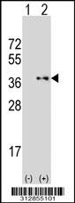 Western blot analysis of his-tag MEST (arrow) using his tag antibody. 293 cell lysates (2 ug/lane) either nontransfected (Lane 1) or transiently transfected with the MEST gene