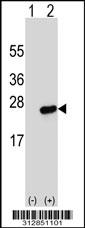 Western blot analysis of his-tag MAFG (arrow) using his tag antibody. 293 cell lysates (2 ug/lane) either nontransfected (Lane 1) or transiently transfected with the MAFG gene