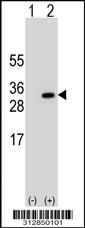 Western blot analysis of his-tag MAD2L1 (arrow) using his tag antibody. 293 cell lysates (2 ug/lane) either nontransfected (Lane 1) or transiently transfected with the MAD2L1 gene