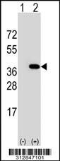 Western blot analysis of his-tag LASP1 (arrow) using his tag antibody. 293 cell lysates (2 ug/lane) either nontransfected (Lane 1) or transiently transfected with the LASP1 gene