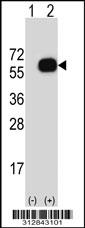Western blot analysis of his-tag ABLIM1 (arrow) using his tag antibody. 293 cell lysates (2 ug/lane) either nontransfected (Lane 1) or transiently transfected with the ABLIM1 gene