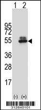 Western blot analysis of his-tag KRT17 (arrow) using his tag antibody. 293 cell lysates (2 ug/lane) either nontransfected (Lane 1) or transiently transfected with the KRT17 gene