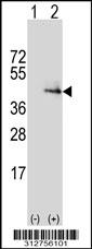 Western blot analysis of his-tag CFI (arrow) using his tag antibody. 293 cell lysates (2 ug/lane) either nontransfected (Lane 1) or transiently transfected with the CFI gene
