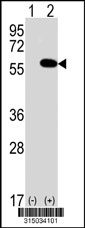 Western blot analysis of his-tag KPNA6 (arrow) using his tag antibody. 293T cell lysates (2 ug/lane) either nontransfected (Lane 1) or transiently transfected with the KPNA6 gene‘