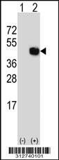 Western blot analysis of his-tag IDS (arrow) using his tag antibody. 293 cell lysates (2 ug/lane) either nontransfected (Lane 1) or transiently transfected with the IDS gene