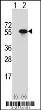 Western blot analysis of his-tag HSD3B1 (arrow) using his tag antibody. 293 cell lysates (2 ug/lane) either nontransfected (Lane 1) or transiently transfected with the HSD3B1 gene