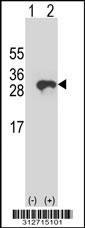 Western blot analysis of his-tag GPX4 (arrow) using his tag antibody. 293 cell lysates (2 ug/lane) either nontransfected (Lane 1) or transiently transfected with the GPX4 gene