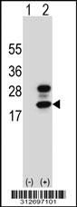 Western blot analysis of his-tag FLT3LG (arrow) using his tag antibody. 293 cell lysates (2 ug/lane) either nontransfected (Lane 1) or transiently transfected with the FLT3LG gene