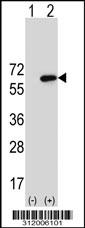 Western blot analysis of his-tag ABCB9 (arrow) using his tag antibody. 293 cell lysates (2 ug/lane) either nontransfected (Lane 1) or transiently transfected with the ABCB9 gene