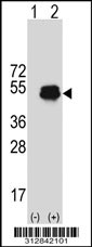 Western blot analysis of his-tag KRT7 (arrow) using his tag antibody. 293T cell lysates (2 ug/lane) either nontransfected (Lane 1) or transiently transfected with the LGALS45 gene
