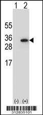 Western blot analysis of his-tag TNNI3 (arrow) using his tag antibody. 293T cell lysates (2 ug/lane) either nontransfected (Lane 1) or transiently transfected with the LGALS42 gene