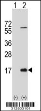 Western blot analysis of his-tag LALBA (arrow) using his tag antibody. 293T cell lysates (2 ug/lane) either nontransfected (Lane 1) or transiently transfected with the LGALS40 gene