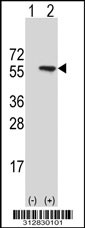 Western blot analysis of his-tag KRT8 (arrow) using his tag antibody. 293T cell lysates (2 ug/lane) either nontransfected (Lane 1) or transiently transfected with the KRT87 gene