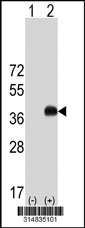 Western blot analysis of his-tag WNT2 (arrow) using his tag antibody. 293T cell lysates (2 ug/lane) either nontransfected (Lane 1) or transiently transfected with the WNT2 gene‘