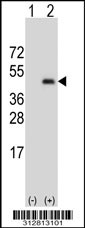 Western blot analysis of his-tag TACSTD1 (arrow) using his tag antibody. 293T cell lysates (2 ug/lane) either nontransfected (Lane 1) or transiently transfected with the TACSTD1 gene