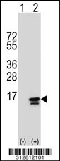 Western blot analysis of his-tag S100B (arrow) using his tag antibody. 293T cell lysates (2 ug/lane) either nontransfected (Lane 1) or transiently transfected with the S100B gene