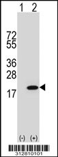 Western blot analysis of his-tag LYZ (arrow) using his tag antibody. 293T cell lysates (2 ug/lane) either nontransfected (Lane 1) or transiently transfected with the LYZ gene