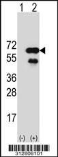Western blot analysis of his-tag KRT6B (arrow) using his tag antibody. 293T cell lysates (2 ug/lane) either nontransfected (Lane 1) or transiently transfected with the KRT6B gene