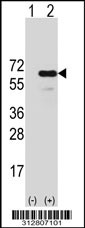 Western blot analysis of his-tag KRT6A (arrow) using his tag antibody. 293T cell lysates (2 ug/lane) either nontransfected (Lane 1) or transiently transfected with the KRT6A gene