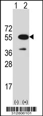 Western blot analysis of his-tag KRT15 (arrow) using his tag antibody. 293T cell lysates (2 ug/lane) either nontransfected (Lane 1) or transiently transfected with the KRT15 gene