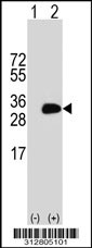 Western blot analysis of his-tag KRAS (arrow) using his tag antibody. 293T cell lysates (2 ug/lane) either nontransfected (Lane 1) or transiently transfected with the KRAS gene