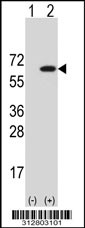 Western blot analysis of his-tag KPNA1 (arrow) using his tag antibody. 293T cell lysates (2 ug/lane) either nontransfected (Lane 1) or transiently transfected with the KPNA1 gene