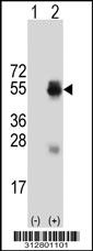 Western blot analysis of his-tag KIR2DL3 (arrow) using his tag antibody. 293T cell lysates (2 ug/lane) either nontransfected (Lane 1) or transiently transfected with the KIR2DL30 gene