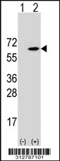 Western blot analysis of his-tag NDST1 (arrow) using his tag antibody. 293T cell lysates (2 ug/lane) either nontransfected (Lane 1) or transiently transfected with the NDST1 gene