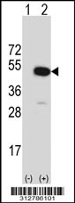 Western blot analysis of his-tag INPP5A (arrow) using his tag antibody. 293T cell lysates (2 ug/lane) either nontransfected (Lane 1) or transiently transfected with the INPP5A gene