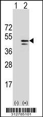 Western blot analysis of his-tag ILF2 (arrow) using his tag antibody. 293T cell lysates (2 ug/lane) either nontransfected (Lane 1) or transiently transfected with the ILF2 gene