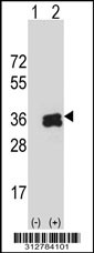 Western blot analysis of his-tag IL9R (arrow) using his tag antibody. 293T cell lysates (2 ug/lane) either nontransfected (Lane 1) or transiently transfected with the LGALS27 gene