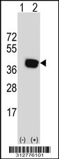 Western blot analysis of his-tag IDH3B (arrow) using his tag antibody. 293T cell lysates (2 ug/lane) either nontransfected (Lane 1) or transiently transfected with the IDH3B gene