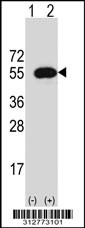 Western blot analysis of his-tag HYAL1 (arrow) using his tag antibody. 293T cell lysates (2 ug/lane) either nontransfected (Lane 1) or transiently transfected with the HYAL1 gene