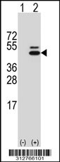Western blot analysis of his-tag HOXD10 (arrow) using his tag antibody. 293T cell lysates (2 ug/lane) either nontransfected (Lane 1) or transiently transfected with the HOXD10 gene