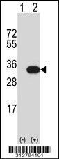 Western blot analysis of his-tag HOXB7 (arrow) using his tag antibody. 293T cell lysates (2 ug/lane) either nontransfected (Lane 1) or transiently transfected with the HOXB7 gene