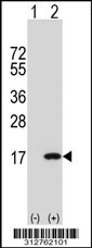 Western blot analysis of his-tag HOXA10 (arrow) using his tag antibody. 293T cell lysates (2 ug/lane) either nontransfected (Lane 1) or transiently transfected with the LGALS25 gene