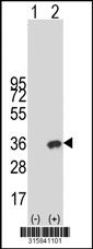Western blot analysis of his-tag PYHIN1 (arrow) using his tag antibody. 293T cell lysates (2 ug/lane) either nontransfected (Lane 1) or transiently transfected with the PYHIN1 gene‘