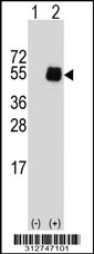 Western blot analysis of his-tag IL2RG (arrow) using his tag antibody. 293T cell lysates (2 ug/lane) either nontransfected (Lane 1) or transiently transfected with the IL2RG gene