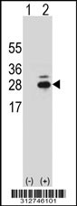 Western blot analysis of his-tag IGLL1 (arrow) using his tag antibody. 293T cell lysates (2 ug/lane) either nontransfected (Lane 1) or transiently transfected with the IGLL1 gene