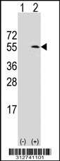 Western blot analysis of his-tag IFIT1 (arrow) using his tag antibody. 293T cell lysates (2 ug/lane) either nontransfected (Lane 1) or transiently transfected with the IFIT1 gene