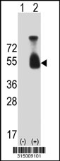 Western blot analysis of his-tag DGCR2 (arrow) using his tag antibody. 293T cell lysates (2 ug/lane) either nontransfected (Lane 1) or transiently transfected with the DGCR2 gene‘