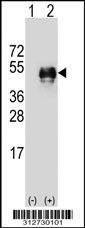 Western blot analysis of his-tag HOXA1 (arrow) using his tag antibody. 293T cell lysates (2 ug/lane) either nontransfected (Lane 1) or transiently transfected with the HOXA1 gene