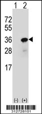 Western blot analysis of his-tag HLA-DPA1 (arrow) using his tag antibody. 293T cell lysates (2 ug/lane) either nontransfected (Lane 1) or transiently transfected with the HLA-DPA1 gene