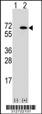 Western blot analysis of his-tag HAL (arrow) using his tag antibody. 293T cell lysates (2 ug/lane) either nontransfected (Lane 1) or transiently transfected with the HAL gene