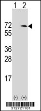 Western blot analysis of his-tag GUSB (arrow) using his tag antibody. 293T cell lysates (2 ug/lane) either nontransfected (Lane 1) or transiently transfected with the GUSB gene