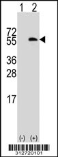 Western blot analysis of his-tag GTF2A1 (arrow) using his tag antibody. 293T cell lysates (2 ug/lane) either nontransfected (Lane 1) or transiently transfected with the GTF2A1 gene